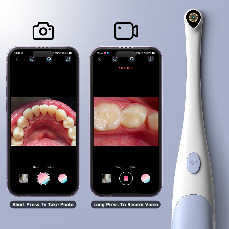 TYPE-C Visual Oral Camera for  - Endoscope Inspection Camera 评论和价格